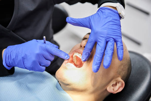 Best Emergency Broken Tooth Repair in Ingleside, TX