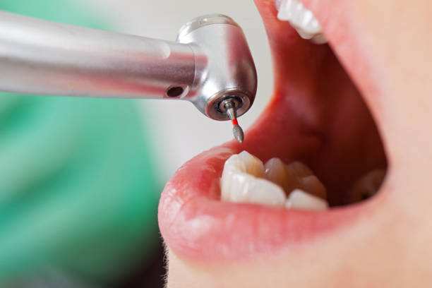 Best After-Hours Emergency Dentist in Ingleside, TX